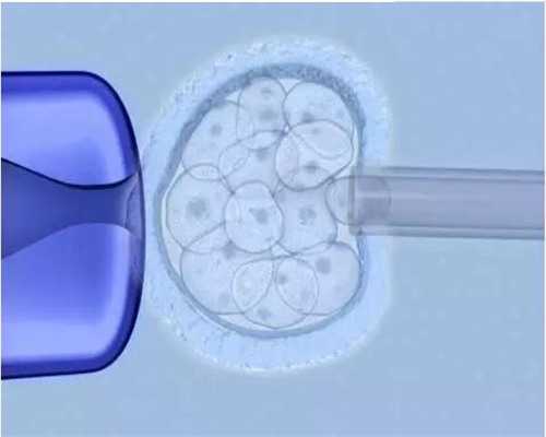 什么是四维彩超医生回答