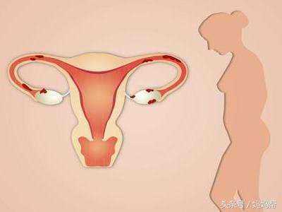 代怀咨询男孩-疑似多囊卵巢、卵泡发育不良，促排两个月成功