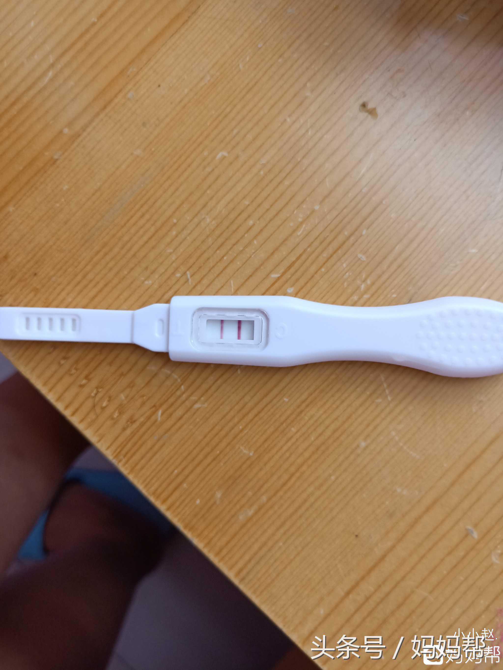 代怀咨询男孩-疑似多囊卵巢、卵泡发育不良，促排两个月成功